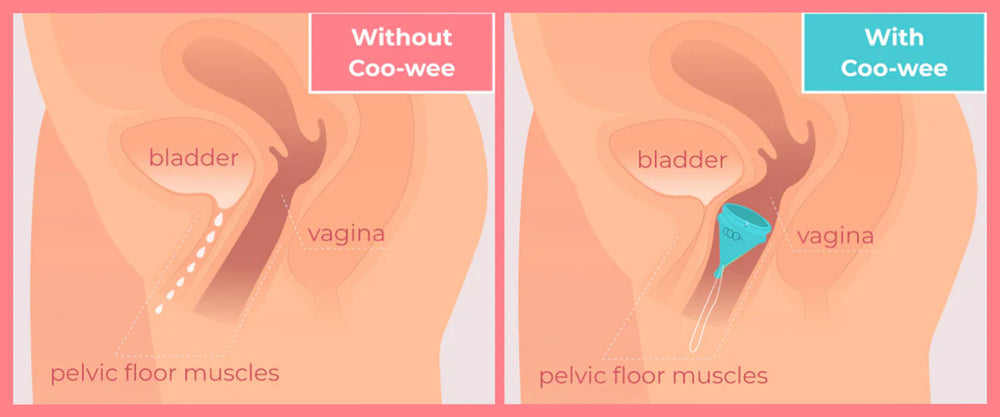 Before and after comparison diagram